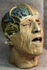 [Anatomical death mask]
