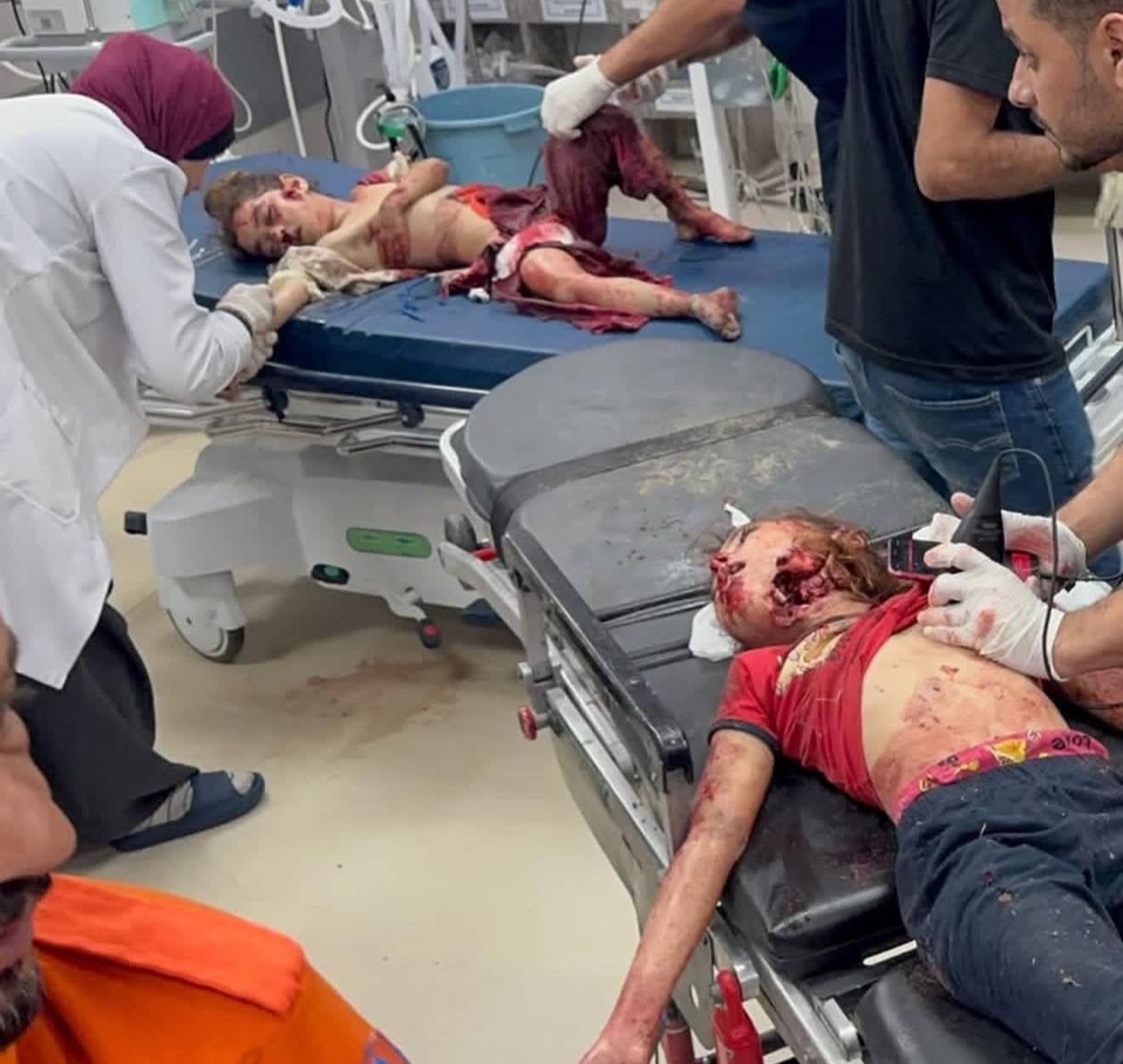 A bloodied body of a small child on a hospital trolley