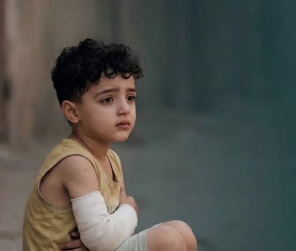 A small boy with a bandaged arm, against an out-of-focus background
